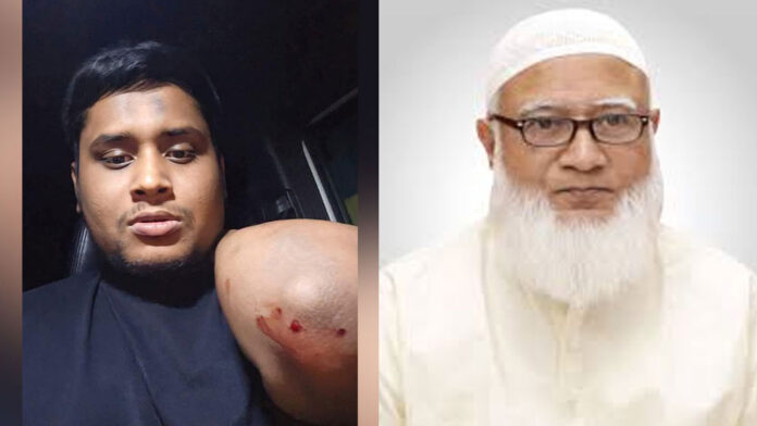 হাসনাতের ওপর হামলায় জামায়াত আমিরের নিন্দা হাসনাতের ওপর হামলায় জামায়াত আমিরের নিন্দা