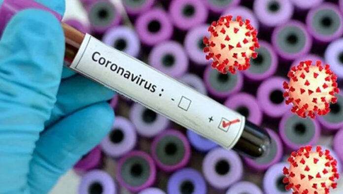 ২৪ ঘণ্টায় করোনায় আরও ৩ জনের মৃত্যু, শনাক্ত ১৯