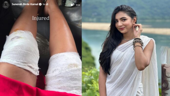 শুটিং সেটে গুরুতর আহত অভিনেত্রী সুনেরাহ শুটিং সেটে গুরুতর আহত অভিনেত্রী সুনেরাহ