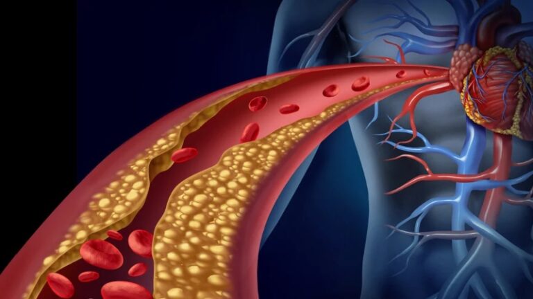 রান্নাঘরের এই সহজলভ্য উপাদানেই দূর হবে কোলেস্টেরল