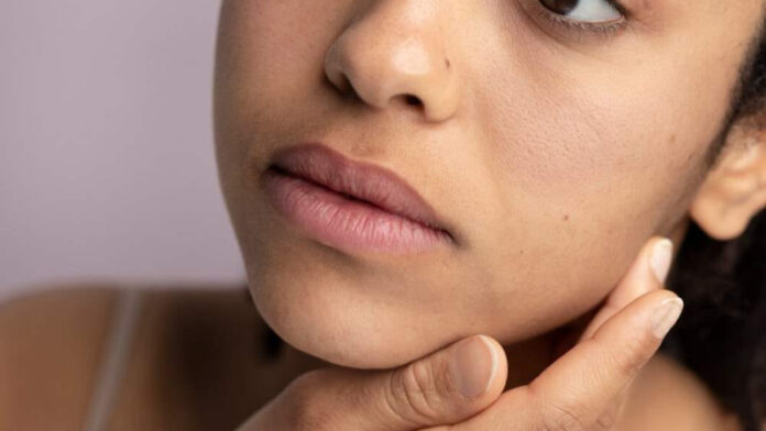 শীতে ত্বক কালো হয়ে যাচ্ছে কারণ ও প্রতিকার জানুন