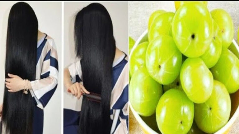 আমলকির তেল কি চুল পড়া বন্ধ করে?