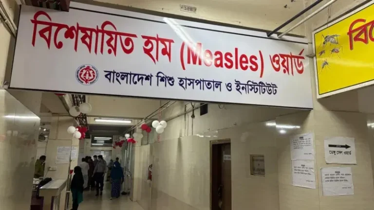 হাম ও হামের উপসর্গে আরও ৭ জনের মৃত্যু