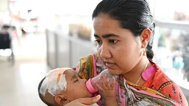 জনস্বাস্থ্য বিশেষজ্ঞদের মূল্যায়ন হাম মোকাবিলায় ব্যর্থতা স্পষ্ট আরও দুই শিশুর মৃত্যু