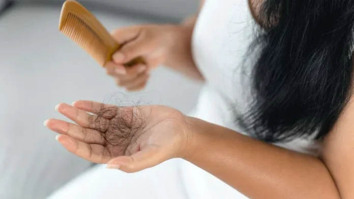 মাত্রাতিরিক্ত চুল পড়ছে ডায়েটে রাখুন ৫ খাবার