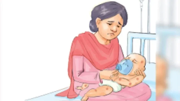 জুলাইয়ে ১১৮ শিশুর মৃত্যু হামের টিকার কার্যকারিতা যাচাইয়ে গবেষণা টিকার ওপর নির্ভরতা, জনস্বাস্থ্য ব্যবস্থায় ঘাটতি